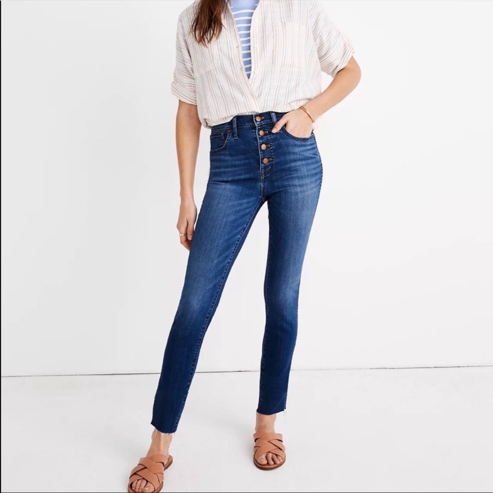 Madewell Button Front 9” High Rise Skinny Jeans